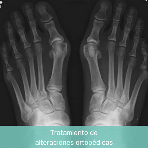 Dr. Eduardo Villanueva Manzo Tratamiendo de alteraciones ortopédicas